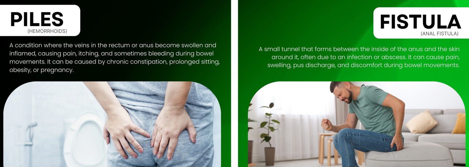 Piles and fistula